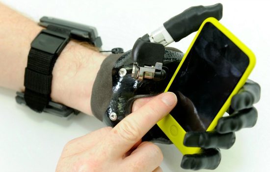 Robotic prosthetic hand enabling regained dexterity and ability